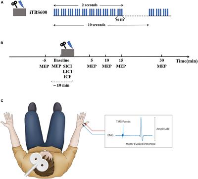 Cortical Inhibition State-Dependent iTBS Induced Neural Plasticity